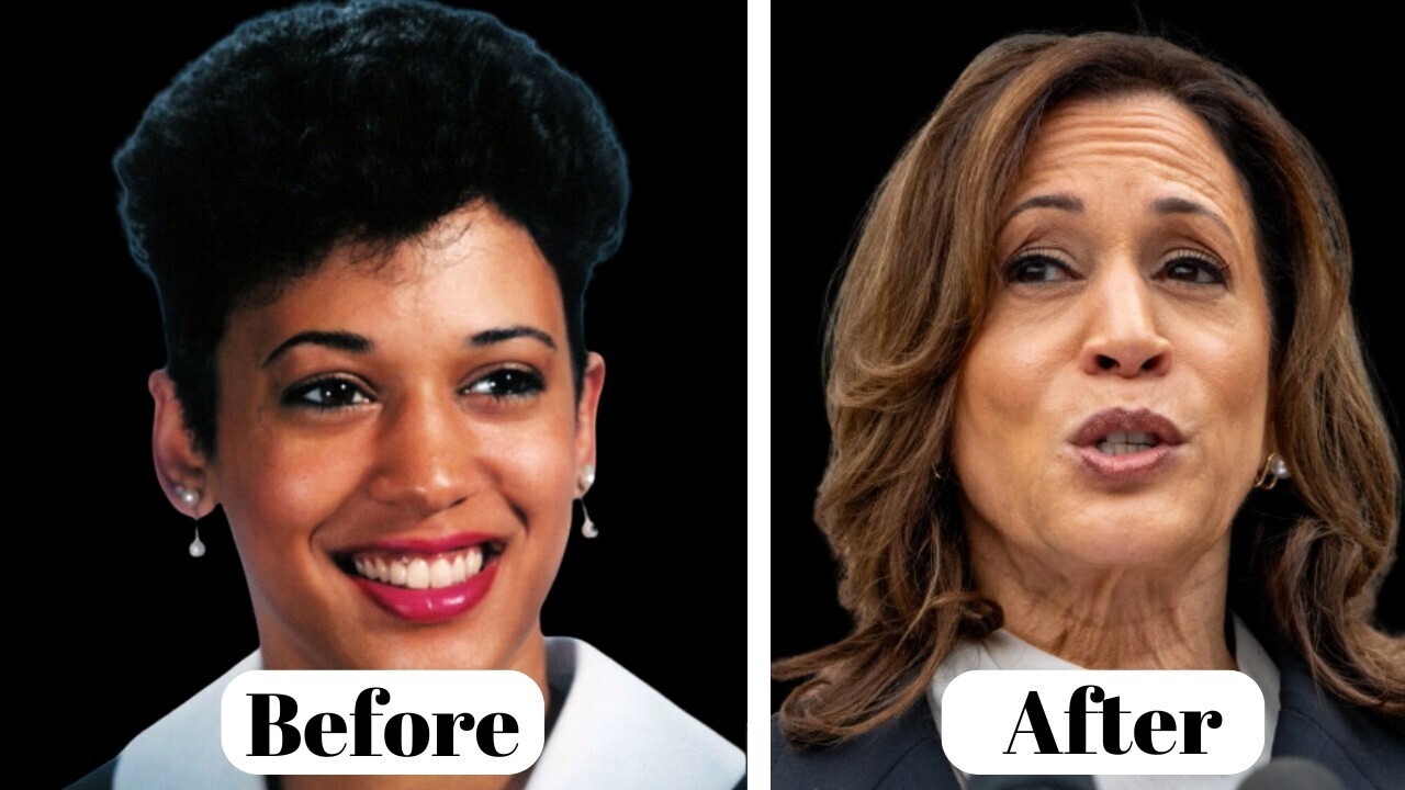 Featured - Kamala Harris Plastic Surgery