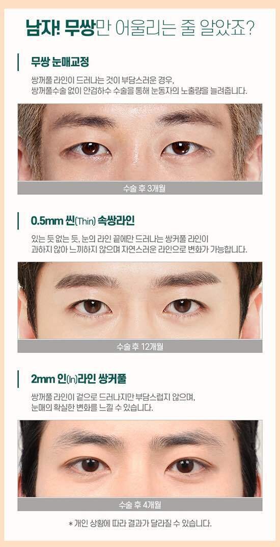 블라인드 | 블라블라: 여자들은 남자 무쌍 속쌍 겉쌍 뭐 좋아하냐