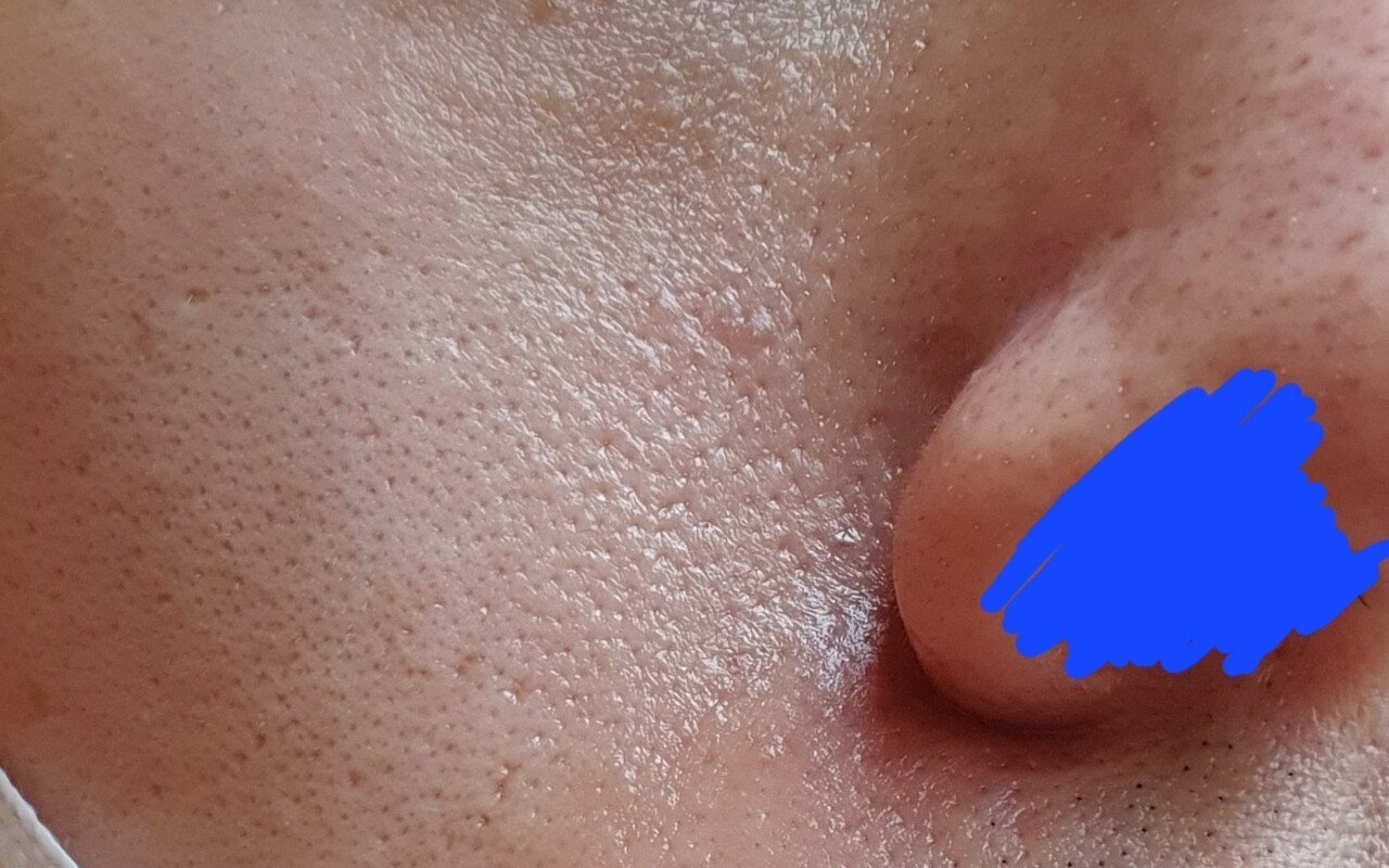 30대 남성용 화장품 추천 모공관리 잘해보세요! 6