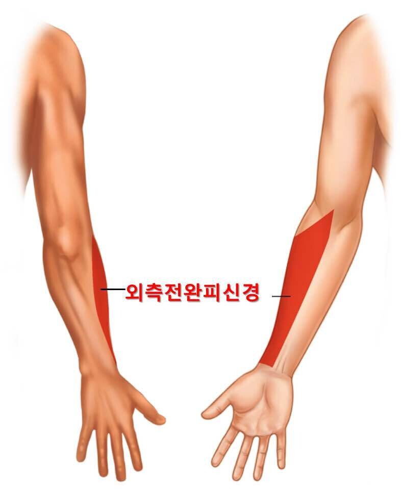 블라인드 | 헬스·다이어트: 여기 팔 근육 키울 수 있어?