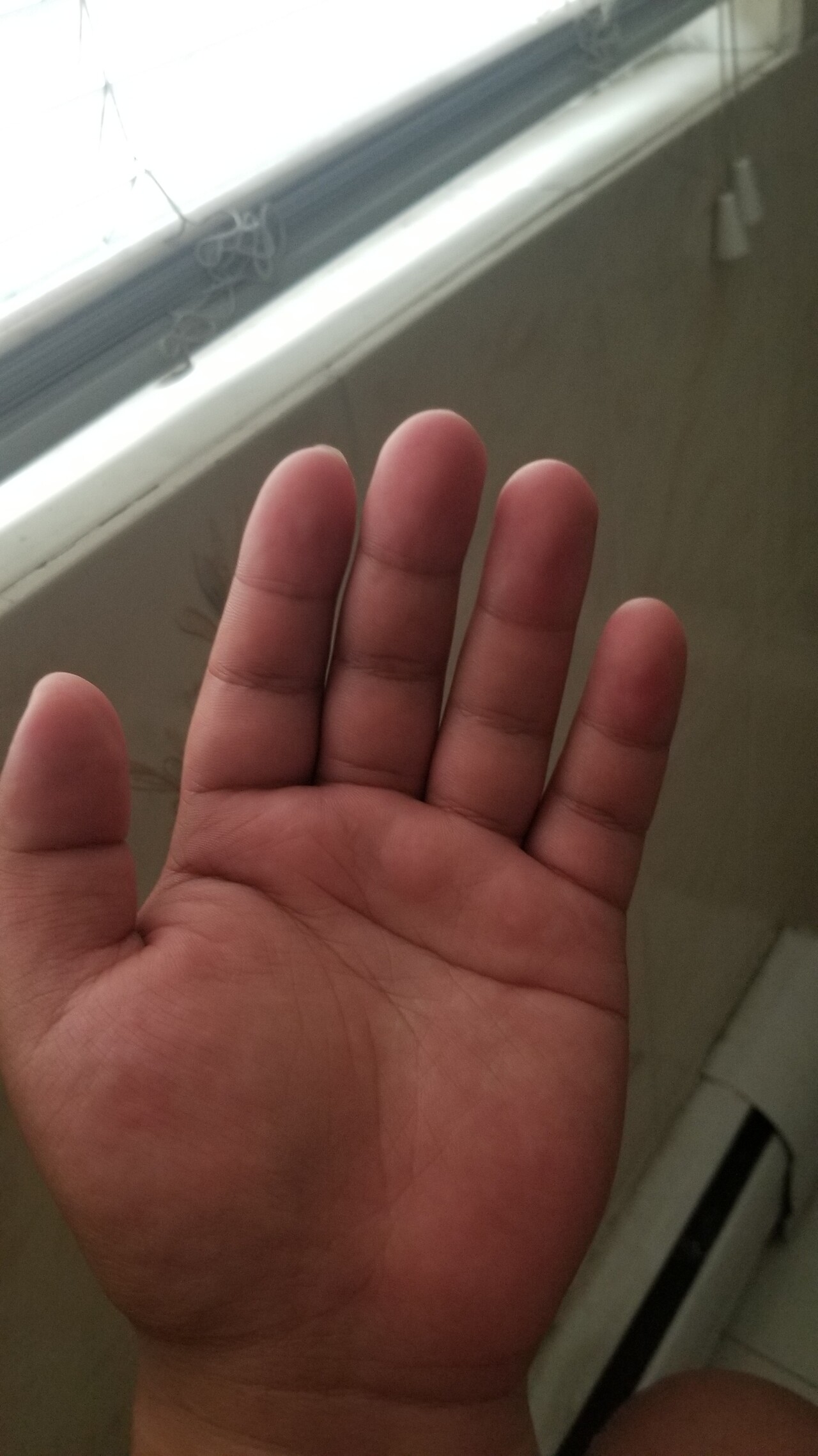 내가 너무 강한게 고민...