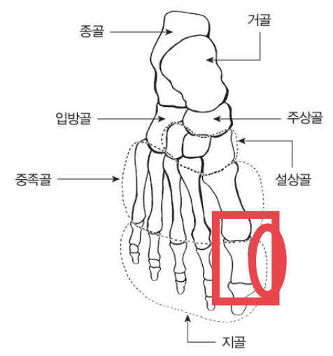 블라인드 | 블라블라: 횽냐들 특이한 발모양인데 신기 편한 신발 추천부탁해 엄지발가락쪽 뼈 지골? 사진에 표시한 부분이 많이 ...