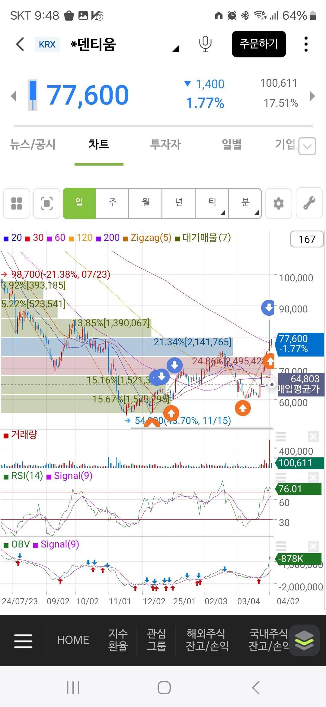 블라인드 | 주식·투자: 내가 덴티움 주식을 트레이딩한 이유와 매수매도 타점 공개