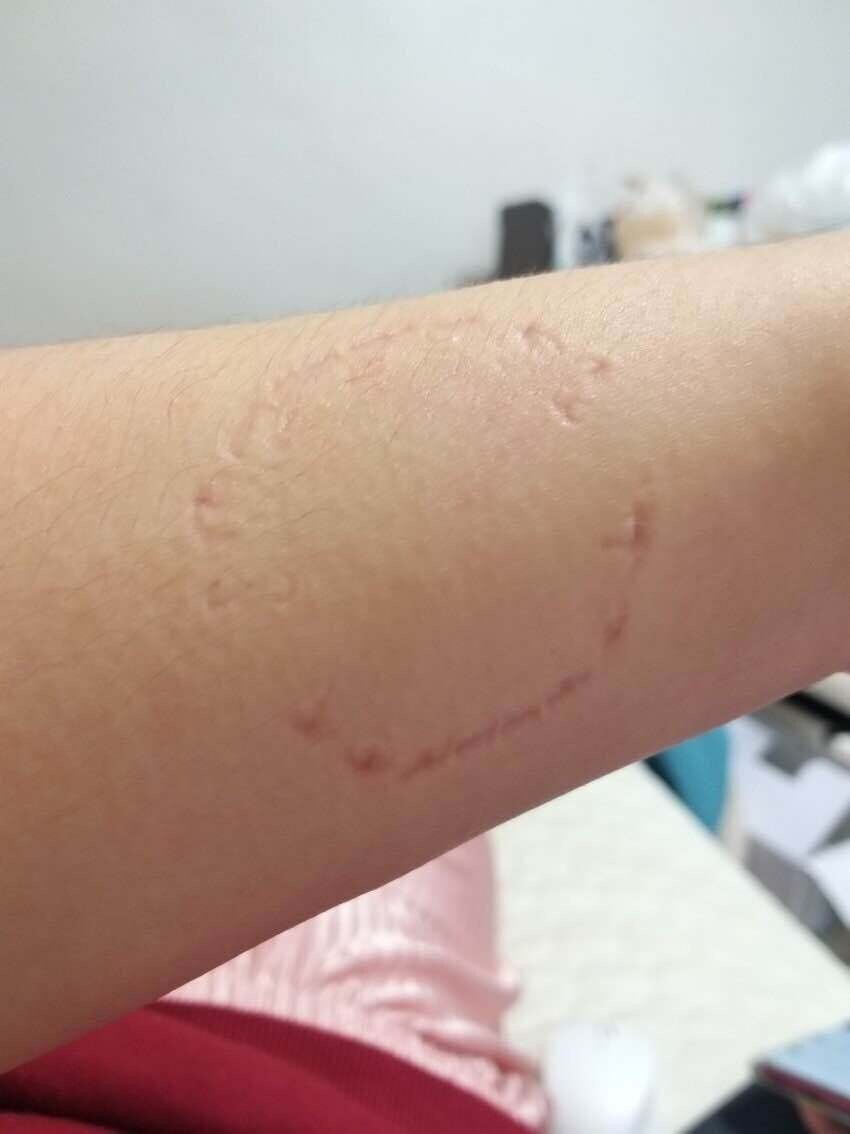 블라인드 | 암호화폐: 메인프레임에 크게 물려서 자해했다...