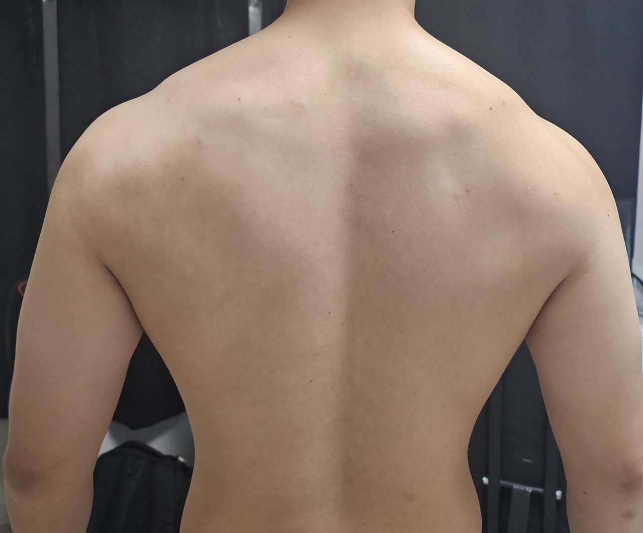 블라인드 | 헬스·다이어트: 하견 슈러그하면 좀 올라갈까요
