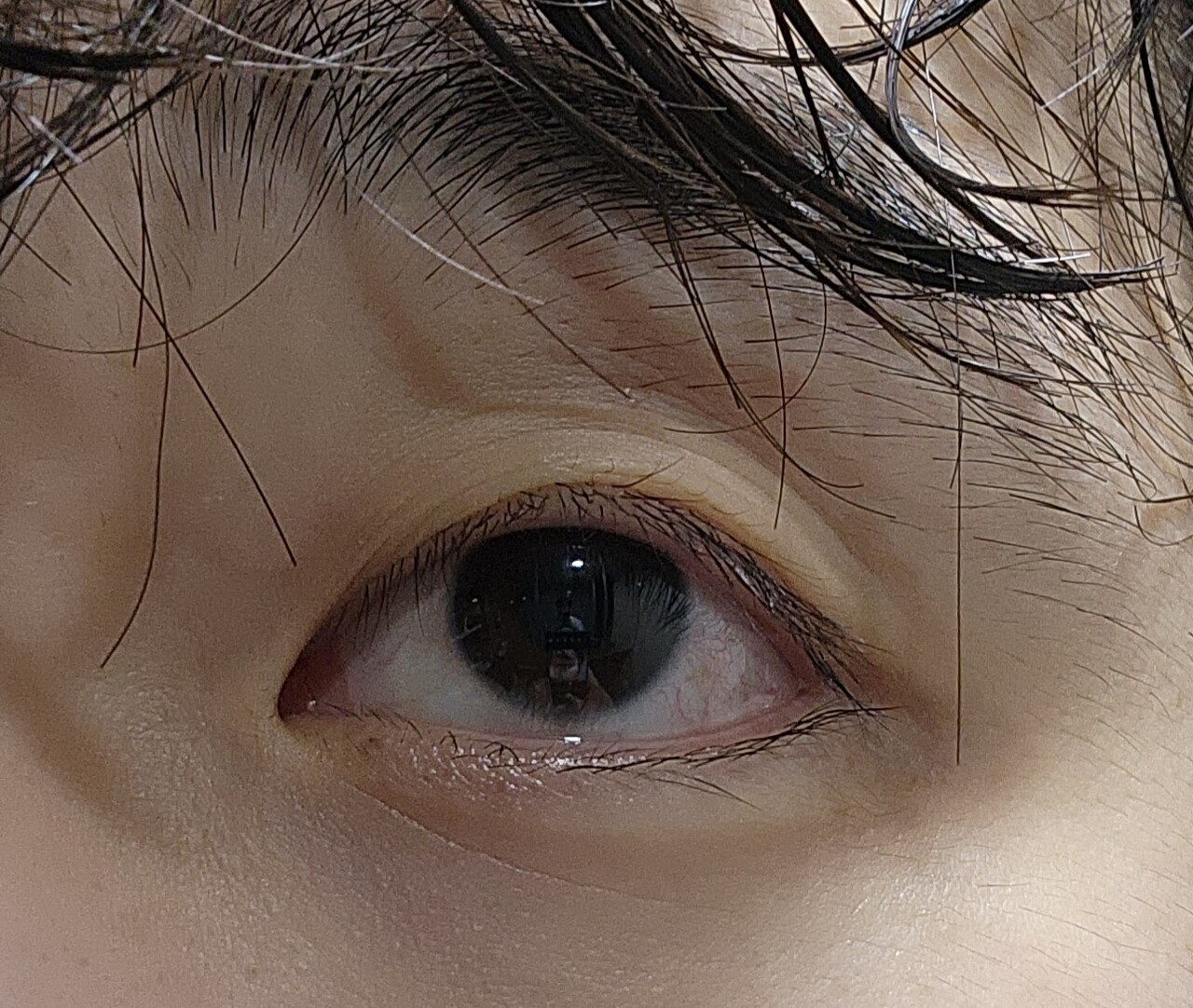 블라인드 | 블라블라: 주름 관리좀 봐주실분 ㅠㅠ