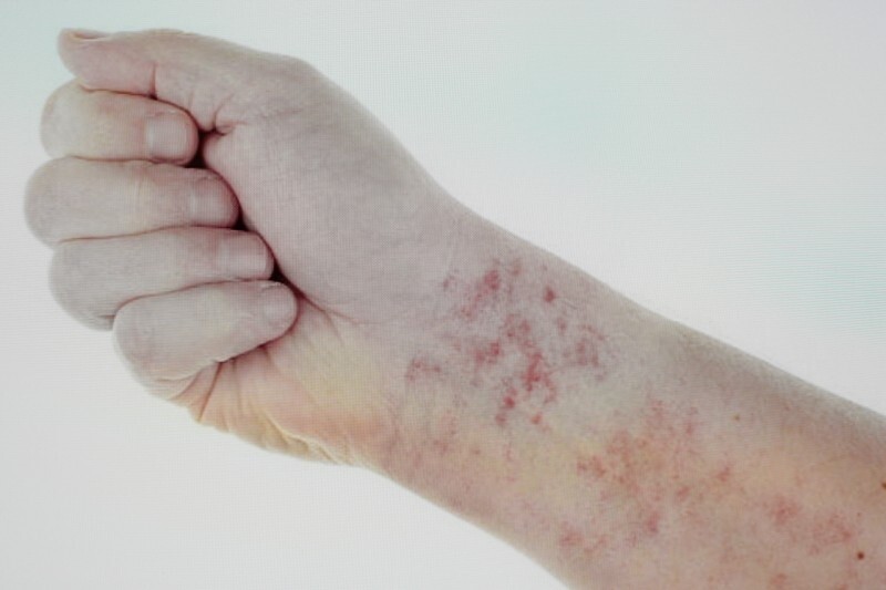 블라인드 블라블라 연진이가 왜 핏줄터지면 방송 못한다고 한지 알겠네